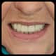 Slider image (10) Dr. Aleksandar Kovacevic - Dental Clinic in Croatia